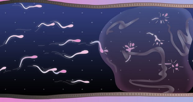 Birth control method