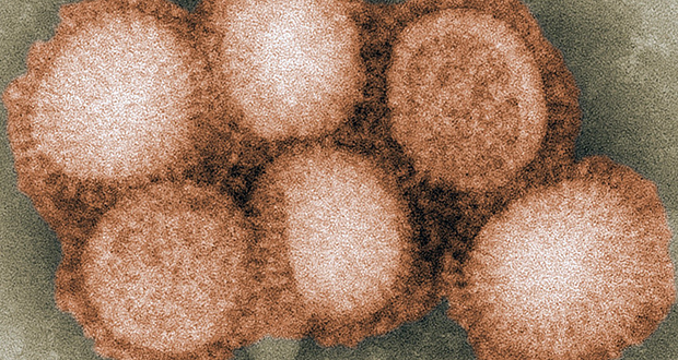 Hong Kong Flu Virus
