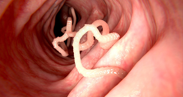 Tapeworm Diet