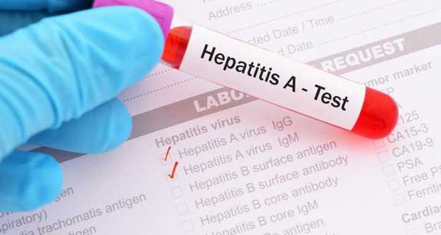 Hepatitis A Outbreaks