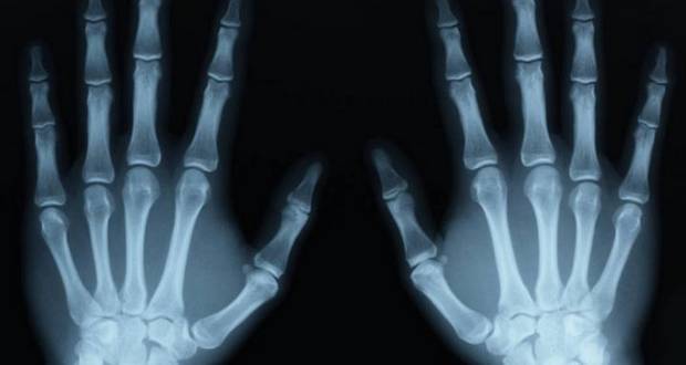 Visible X-Rays?