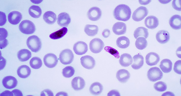 Plasmodium Falciparum 
