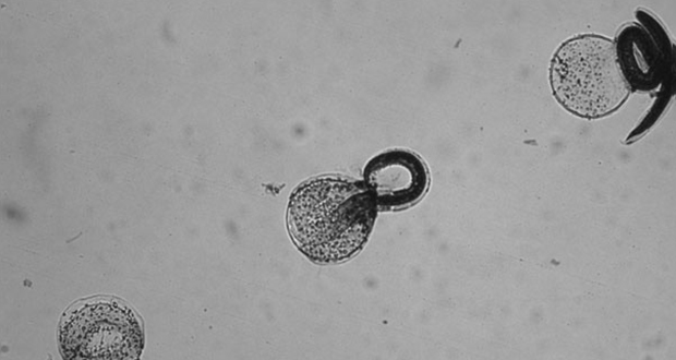 Baylisascaris