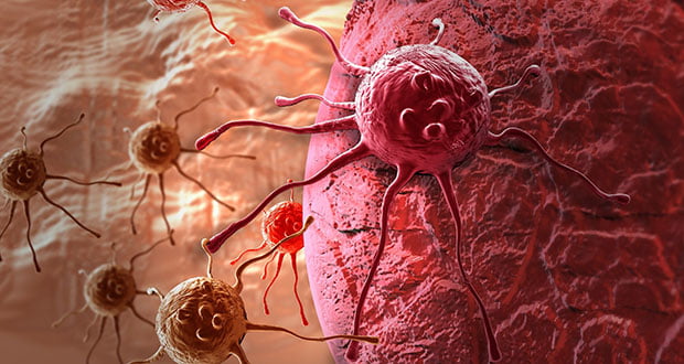 Teratomas: Tumors with Shocking Capabilities