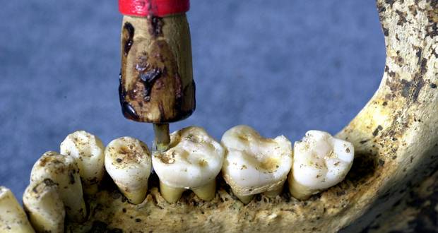 Dentistry's Ancient Roots