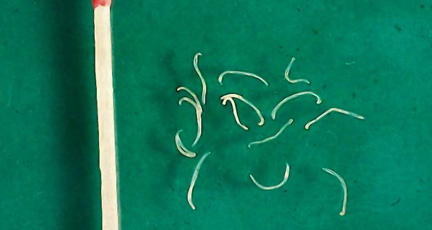 Hookworm Autoimmune Cure