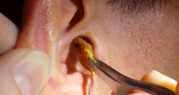 Earwax: Beauty Secret of the 1800s