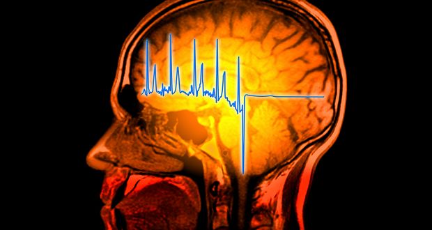 Brain Death Controversy