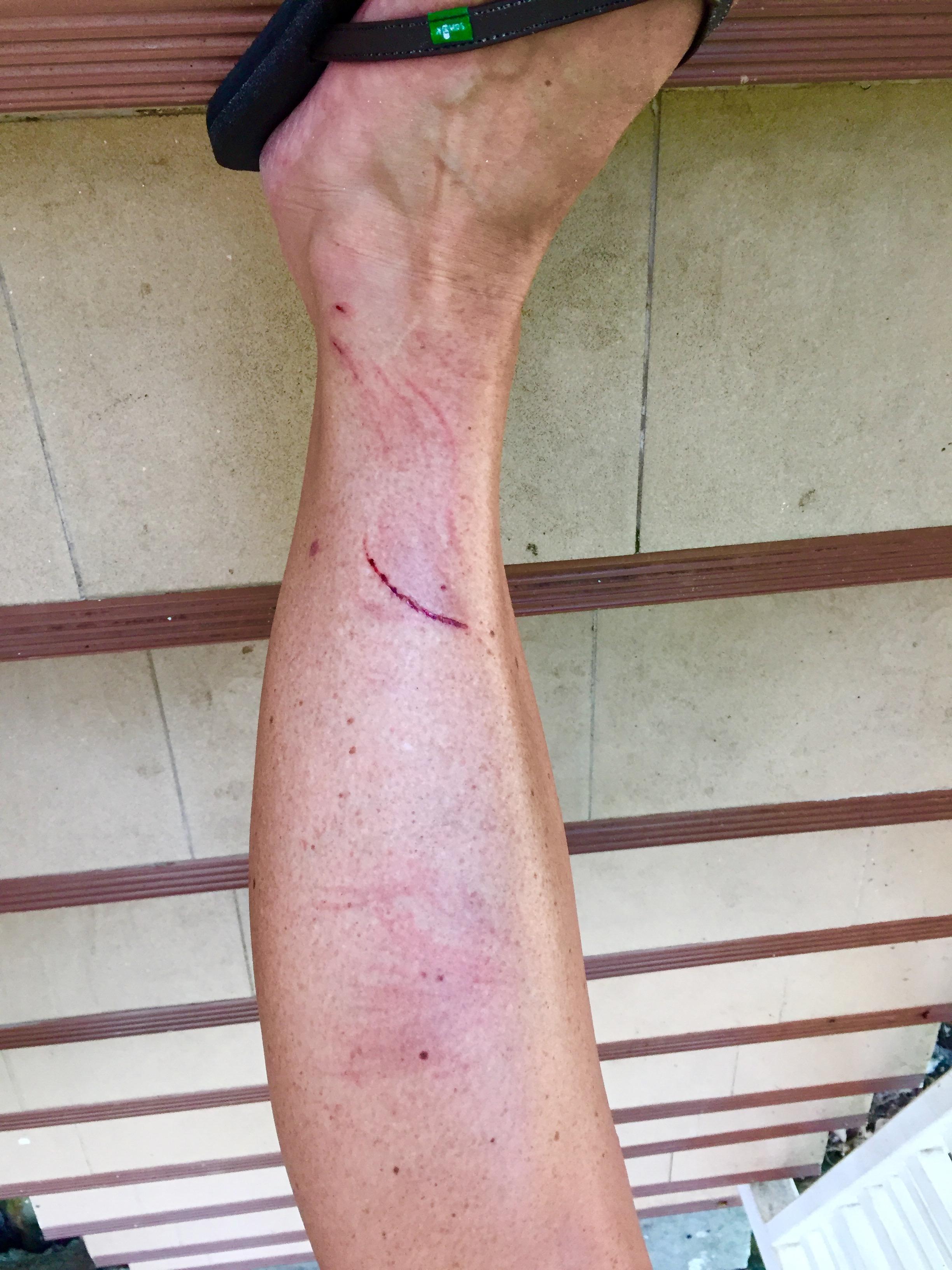 Monkey bite? or running from monkeys? hmmmm....