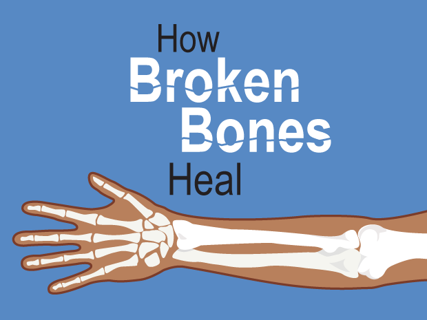 Bones worksheets and online activities. Broken Bones For Parents Nemours Kidshealth