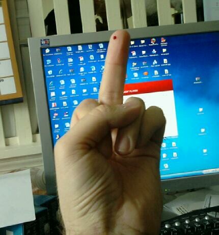 A birdie for diabetes