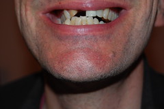 09 07 05_teeth_0005