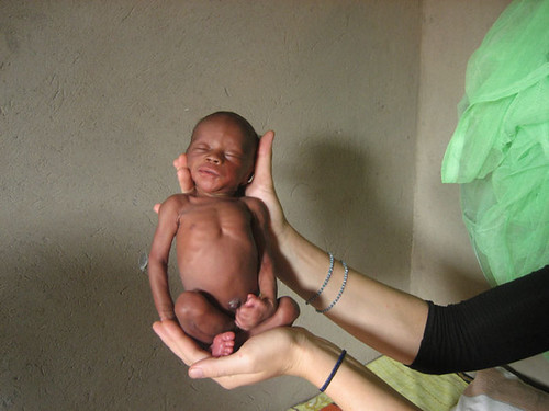tiny baby