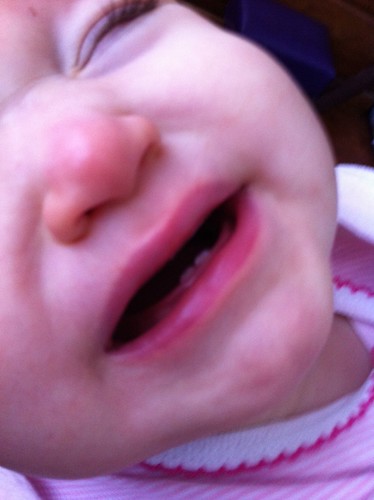 Teeth