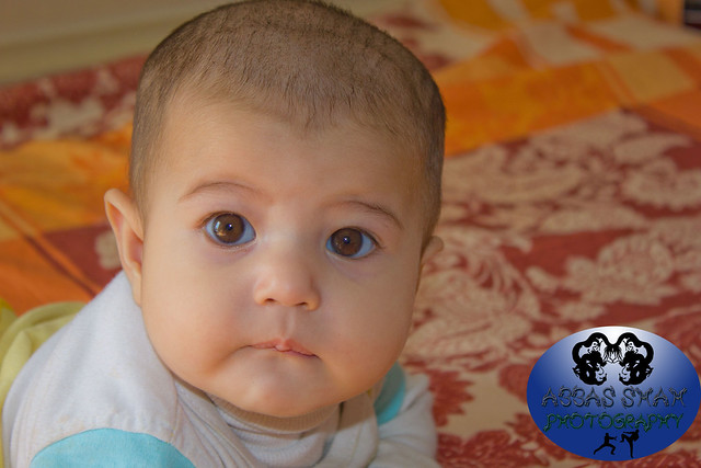 It's currently being used to treat acne and to rejuvenate skin for a more youthful appearance. Baby Girl with Light Brown Eyes | Flickr - Photo Sharing!