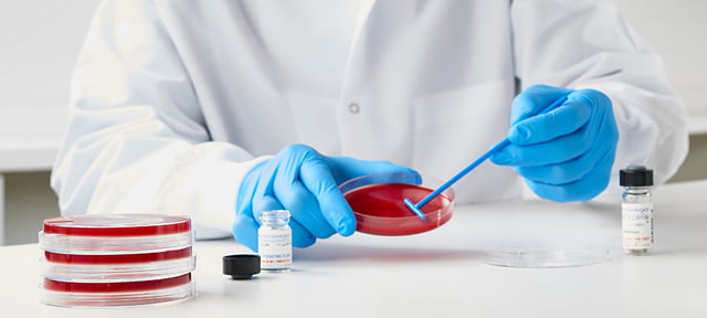 Find out more about the symptoms of lupus and how to get tested. Pentingnya Growth Promotion Testing Gpt Dalam Pengujian Mikrobiologi Farmasi Industri