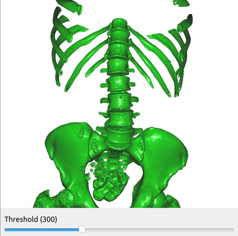Mri Python Ct Csdn - 4K Nature Photos for Desktop