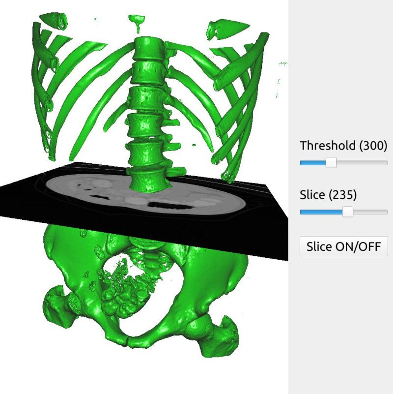 Using Fast On Mri And Ct Images In Python Fast Documentation - Best Geometric Patterns in Full HD