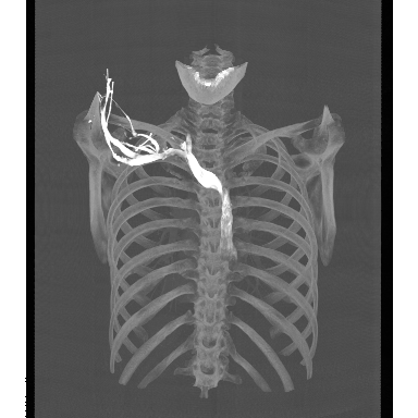 Github Fast Imaging Fast A Framework For High Performance Medical - Premium Space Photo Gallery - HD