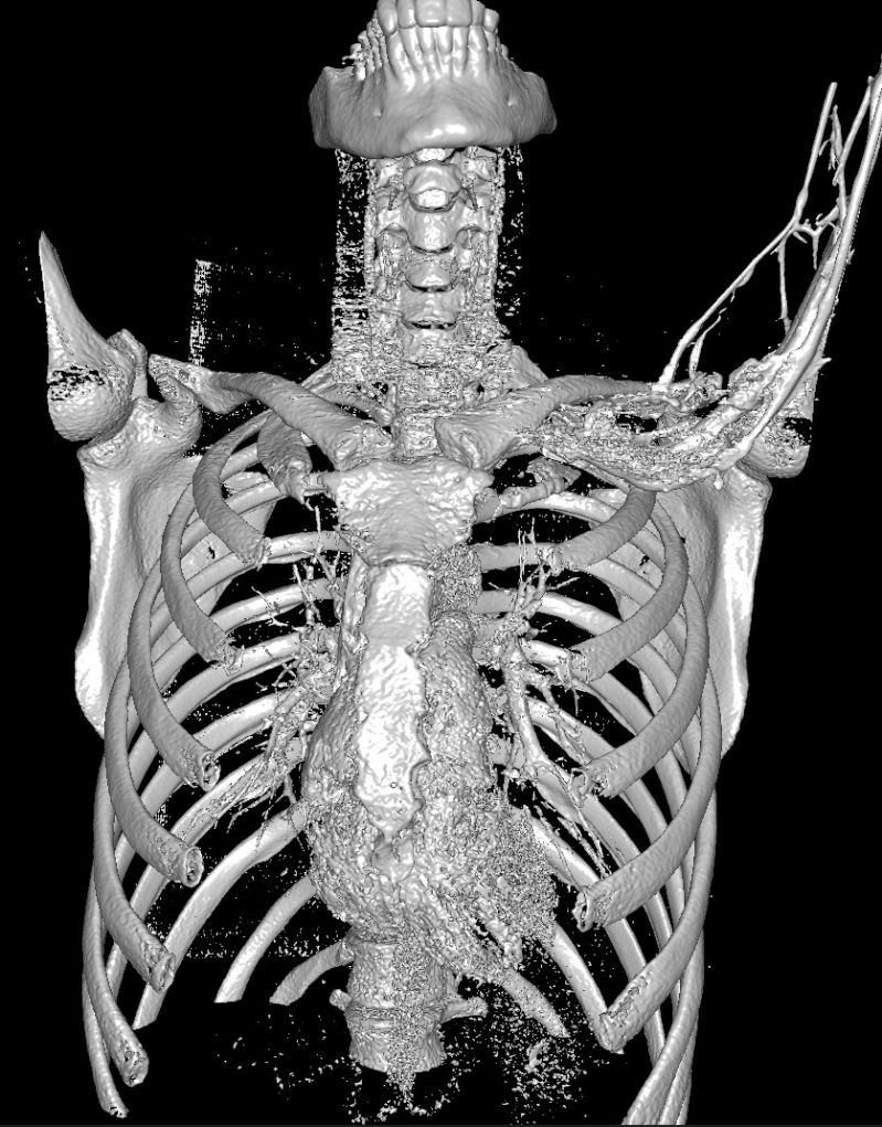 Using Fast On Mri And Ct Images In Python Fast Documentation - Premium Mountain Wallpaper Gallery - Ultra HD