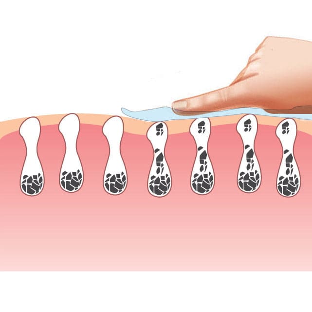 Regular Hand Cleansing