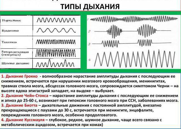 Физиологические и патологические типы дыхания. Патологические типы дыхания