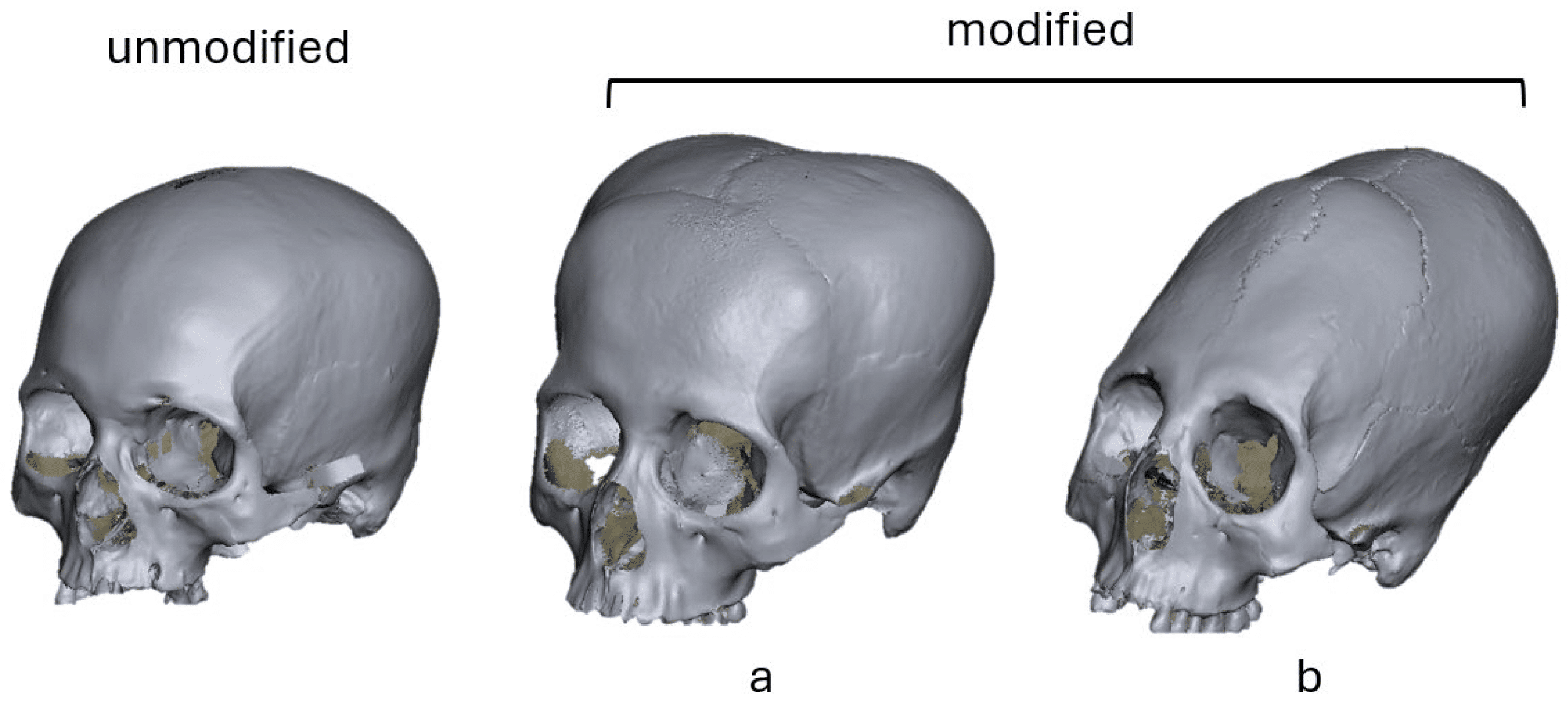 La lezione dei crani peruviani sulla complessità dello sviluppo umano