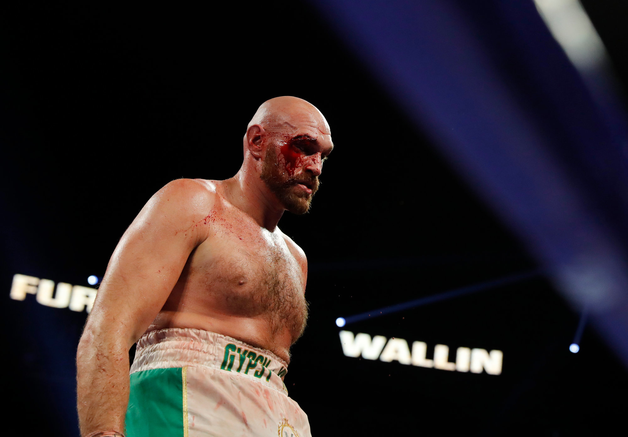 Ждем реванш с тайсоном фьюри? Ð¢Ð°Ð¹ÑÐ¾Ð½ Ð¤ÑŒÑŽÑ€Ð¸: "Ð•ÑÐ»Ð¸ Ñ Ð¿Ñ€ÐµÐºÑ€Ð°Ñ‰Ñƒ Ñ€Ð°Ð±Ð¾Ñ‚Ð°Ñ‚ÑŒ Ð² Ð·Ð°Ð»Ðµ, Ñ‚Ð¾