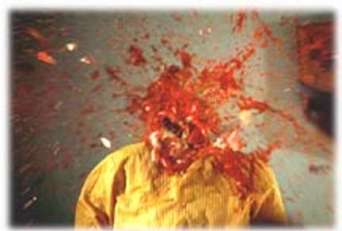 exploding_head