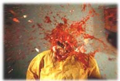 exploding_head