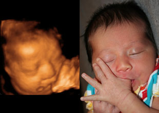 Apesar de espetacular, a ultrassonografia 3d / 4d é uma técnica nova em. Gallery First Impression