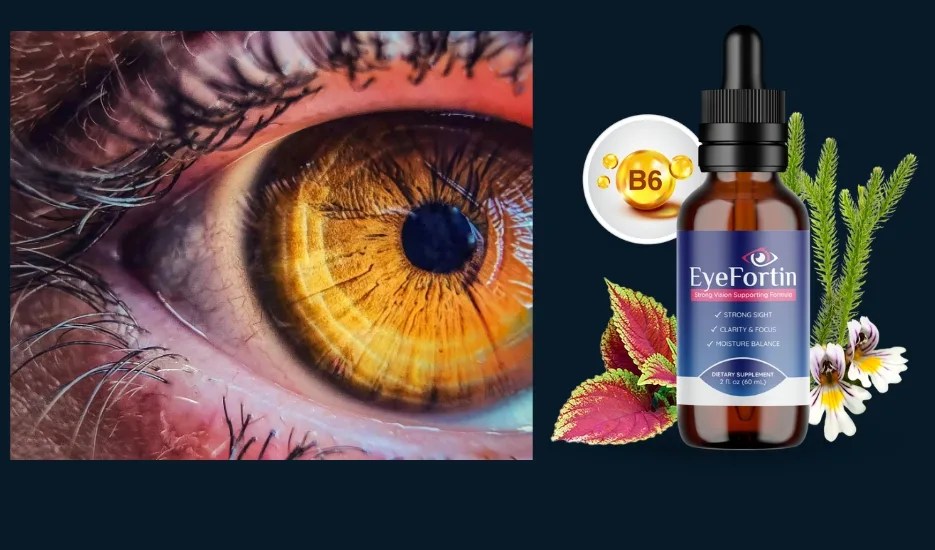 Vision Problems EyeFortin