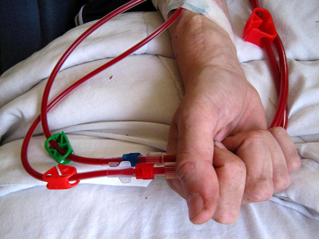 dialysis dialysis inspections