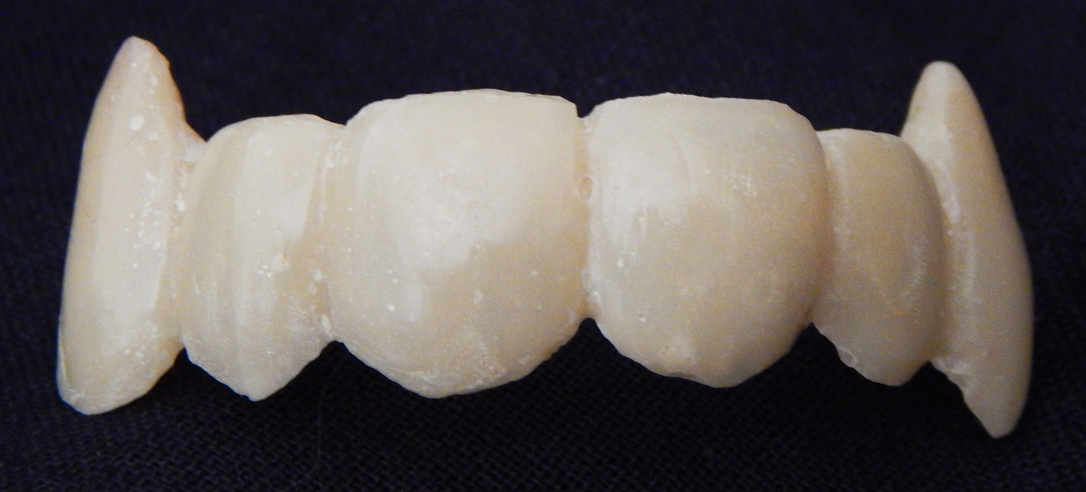 Custom made fangs created for Norine Dresser by Rees Smith, DDS.