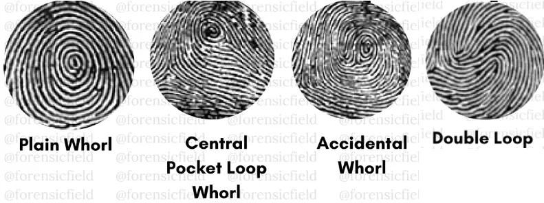 Types Of Fingerprint Patterns - Forensic's blog