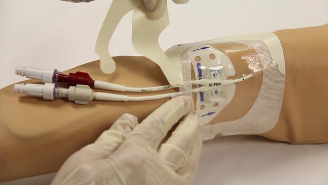 Central Port, PICC Line Central Venous Catheters For Poop Sake