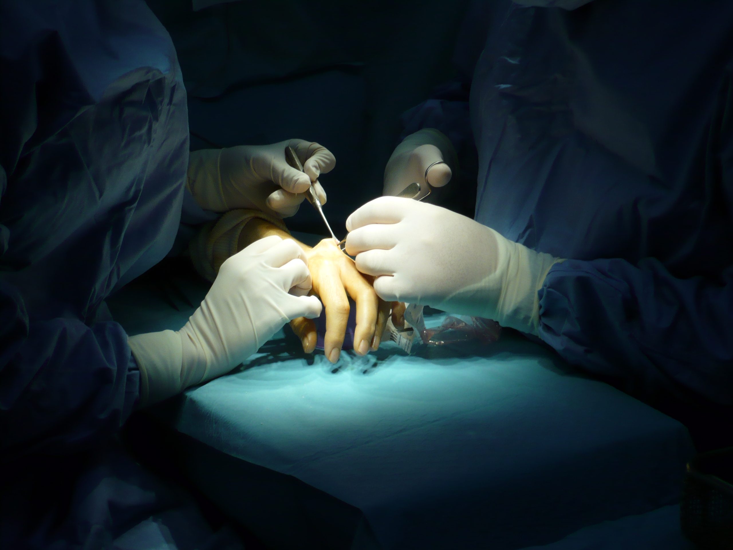 健康・医学 Wide Awake Hand Surgery and Therapy Tips Wide Awake Hand Surgery: 9781498714792: Medicine & Health