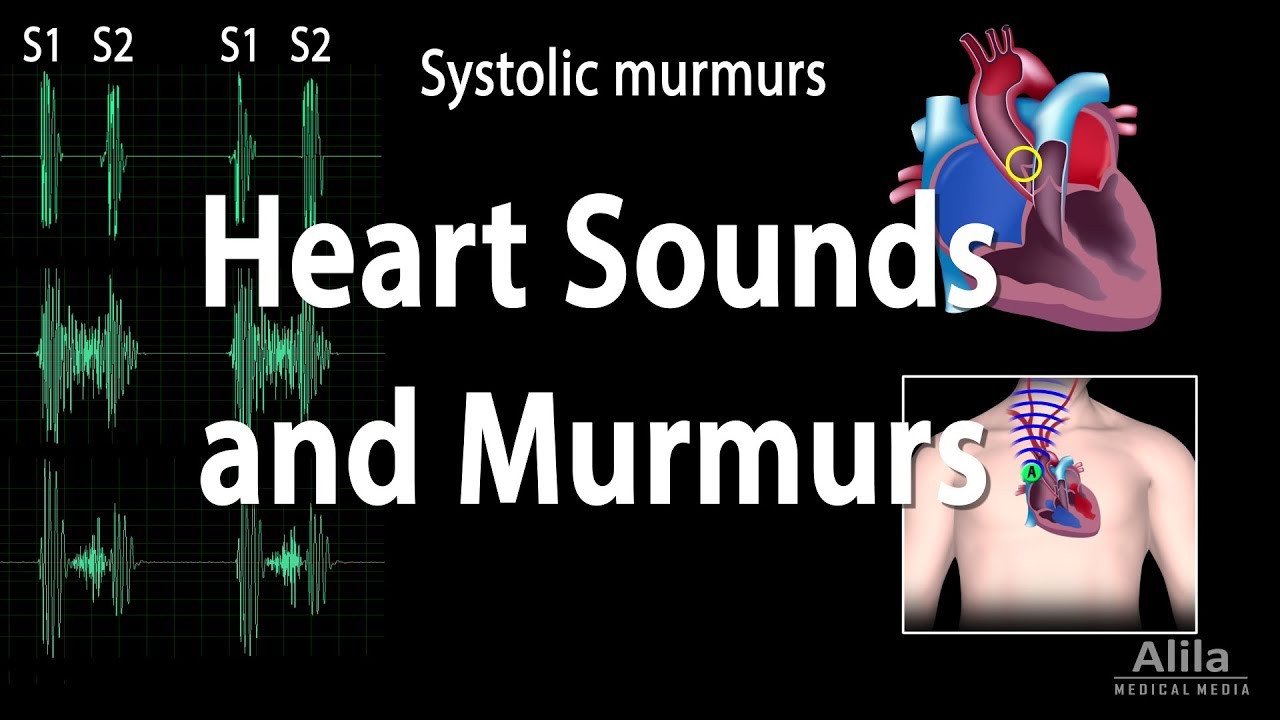 Heart murmur sounds