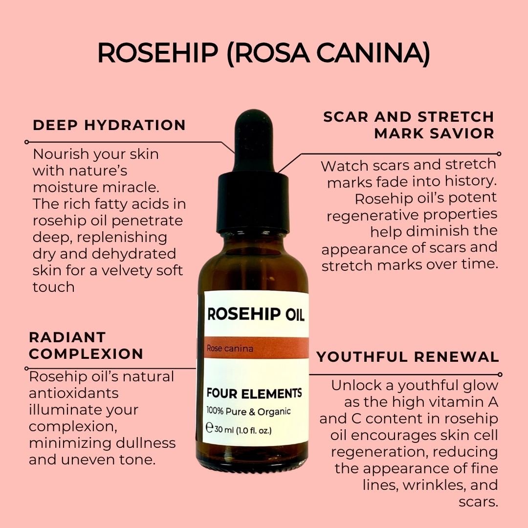 Rosehip Anti-Aging Öl – 100% Rein, 30 Ml – Für Strahlende & Jugendliche Haut