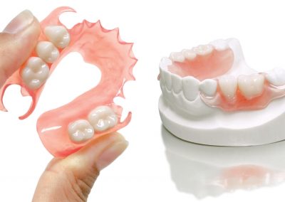 Besonders auf süßes, saures, kälte und wärme reagiert der betroffene zahn empfindlich. Die gÃ¼nstige und patientenfreundliche Prothesen