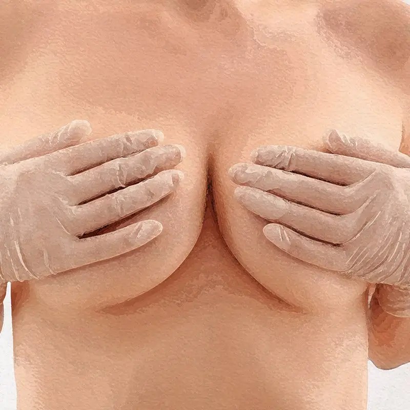 8 Expert Tips to Perfectly Prepare for Breast Augmentation Surgery