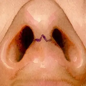 Close-up of the nostrils and columella