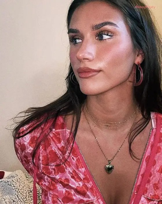 Rhinoplasty patient result