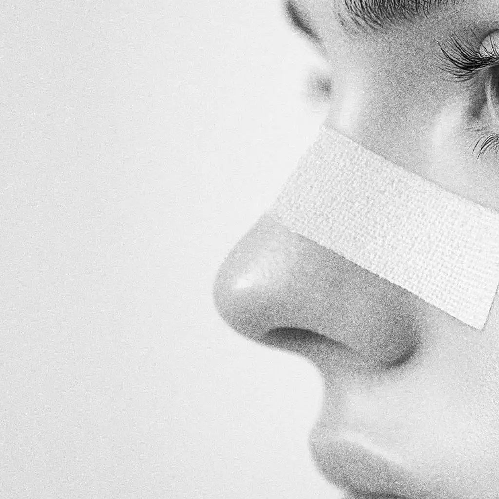 Woman in profile with tape across her nose after rhinoplasty