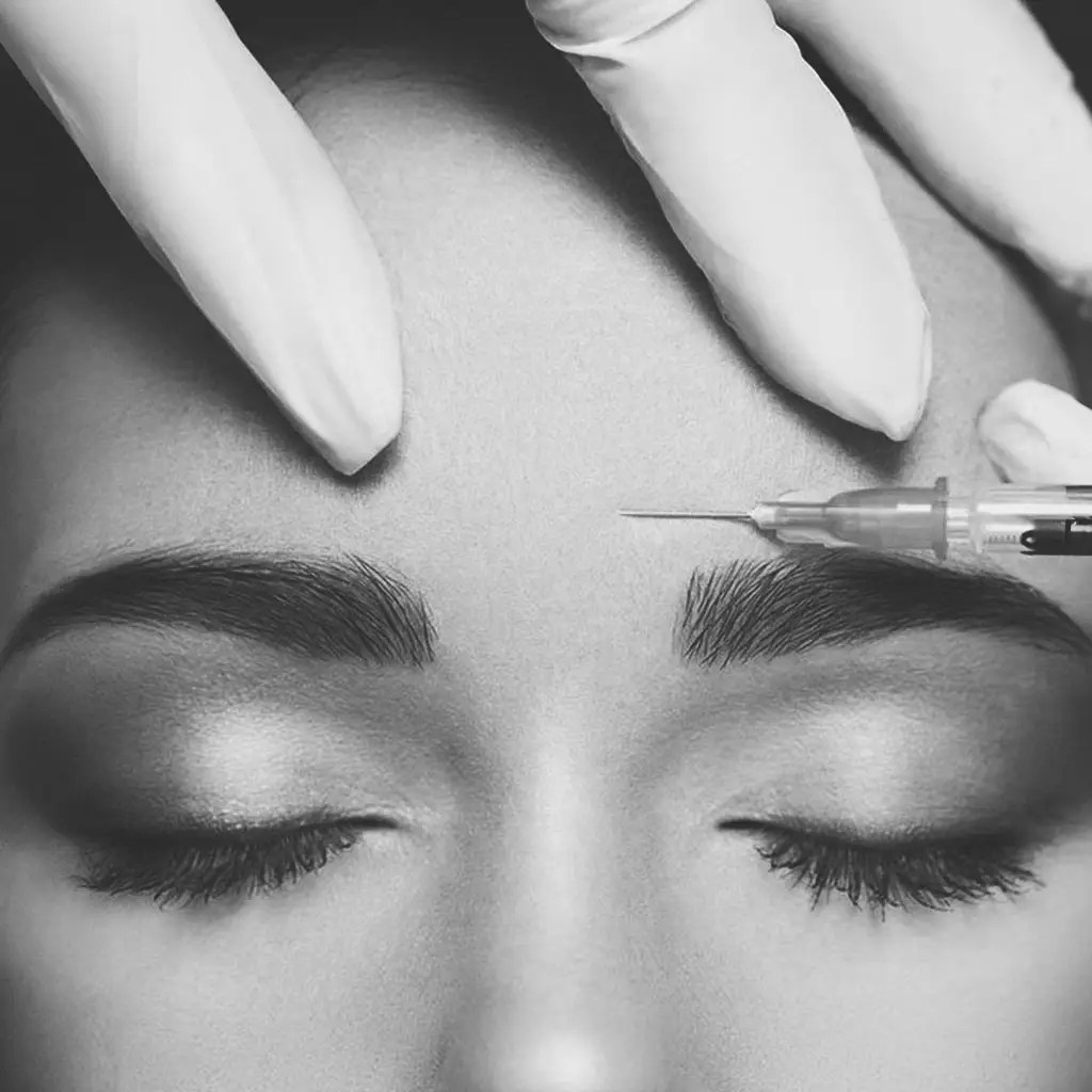 Botox injection between the eyebrows