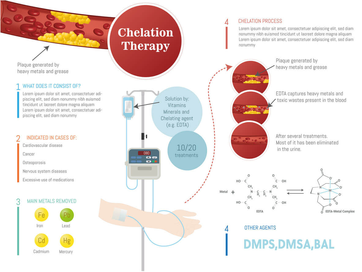 Chelation therapy for lead poisoning: a comprehensive guide