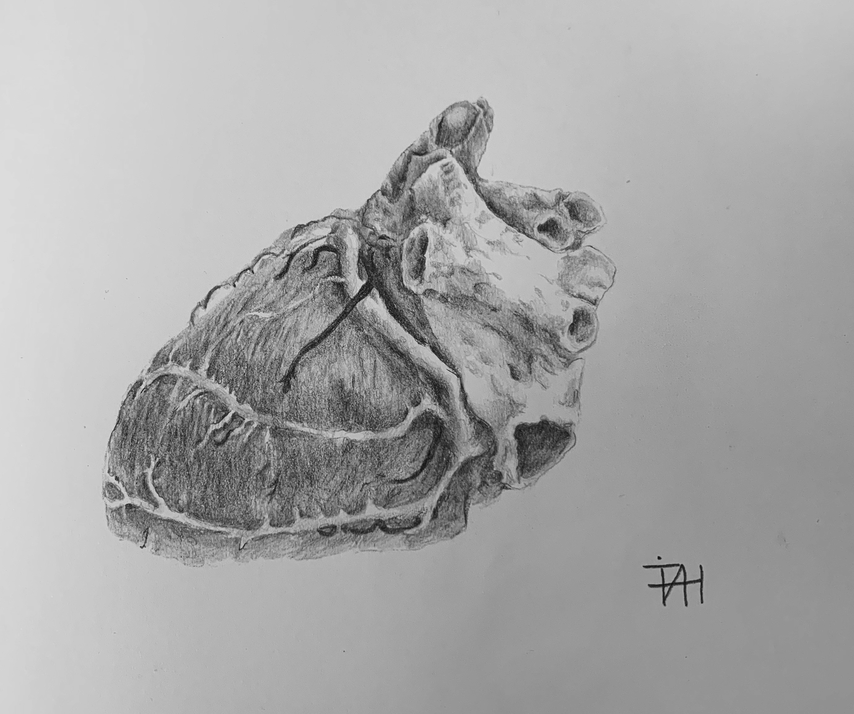 cardiac sketch