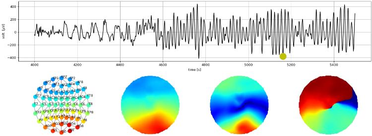 Github Frederic Vw Eeg Patterns - Download Classic City Background | High Resolution