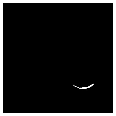 Lung Segmentation Frederik Hartmann - Premium Vintage Pattern Gallery - HD