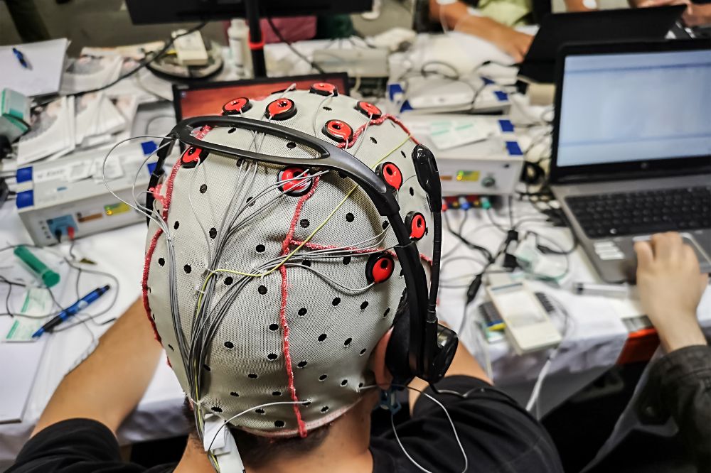 Brain-Computer Interfaces